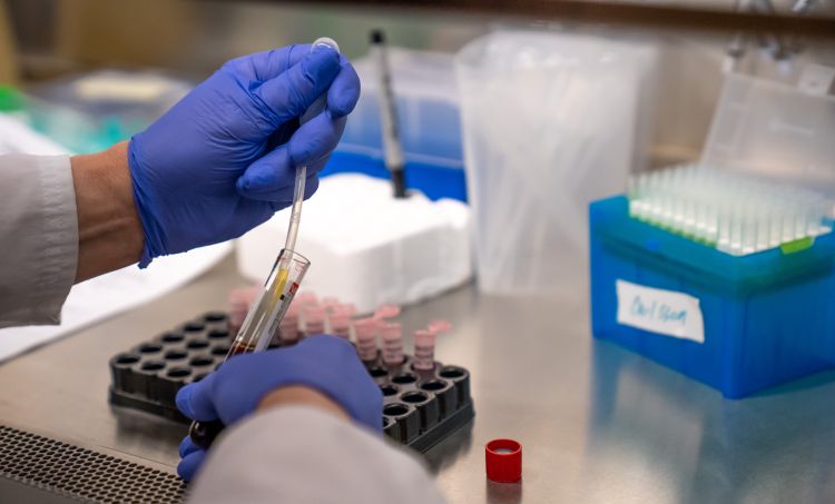 Alzheimer's disease research