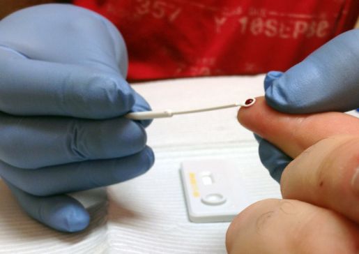 HIV test