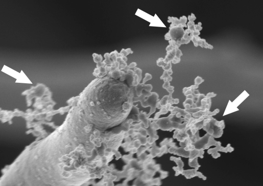 Candida albicans extracellular vesicles