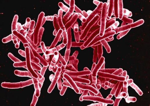 Mycobacterium tuberculosis