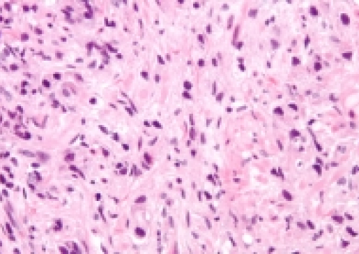 Dr. Douglas McNeel Co-Authors Guidelines for Prostate Cancer Immunotherapy