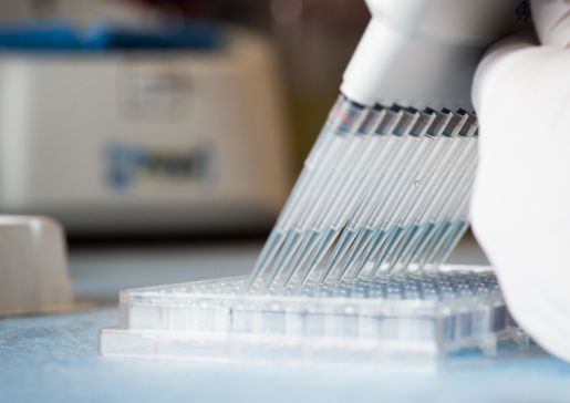 prostate cancer research